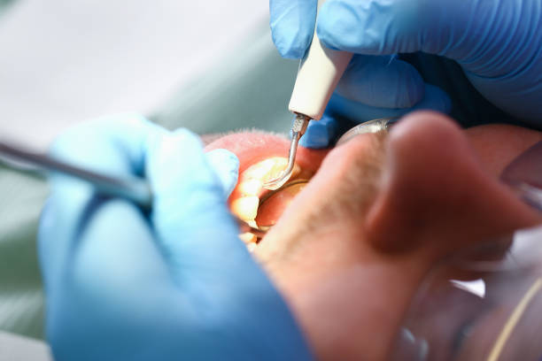 Best Weekend Emergency Dentist in Huron, OH
